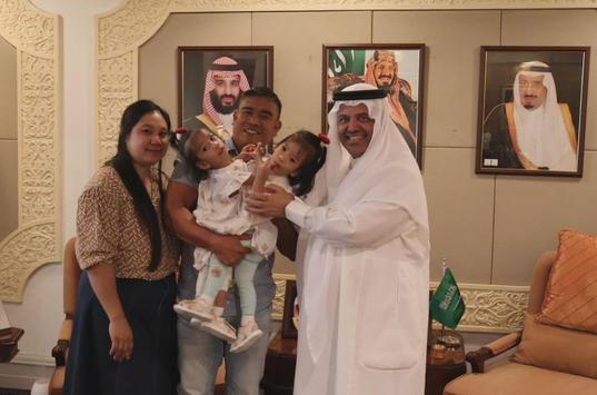 Saudi Arabia separates conjoined twins